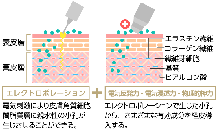 メソポレーション法