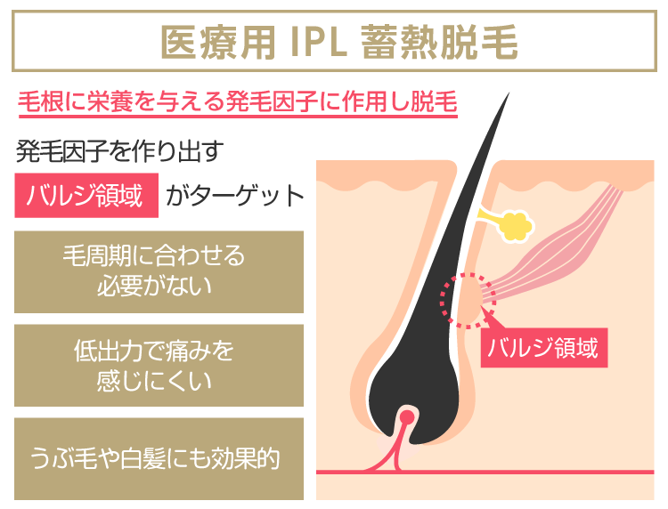 KalonS（カロンS）について