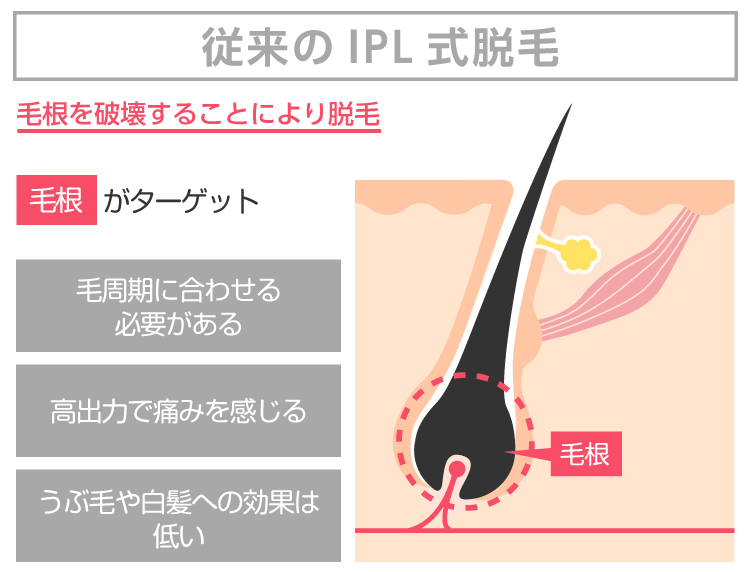KalonS（カロンS）について