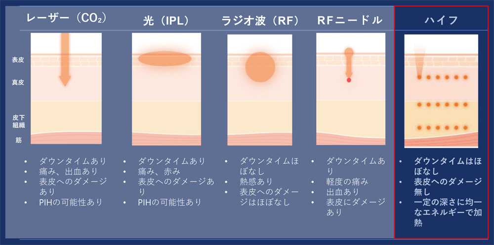 他の治療器との違い