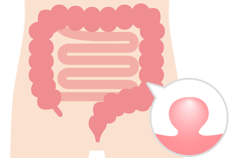 大腸内視鏡